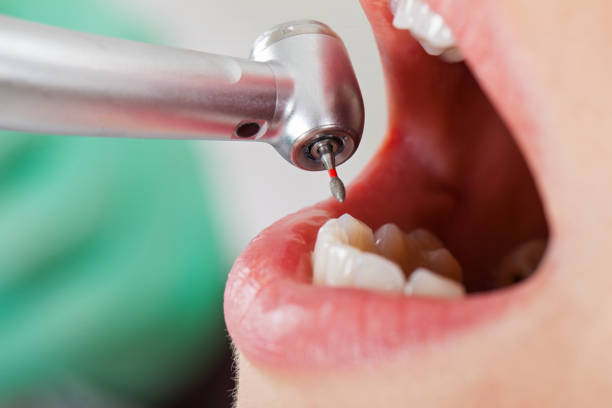 Best Emergency Dental Care for Abscessed Tooth in Seymour, TN